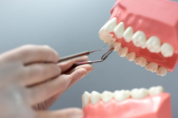 Multiple Tooth Implants
